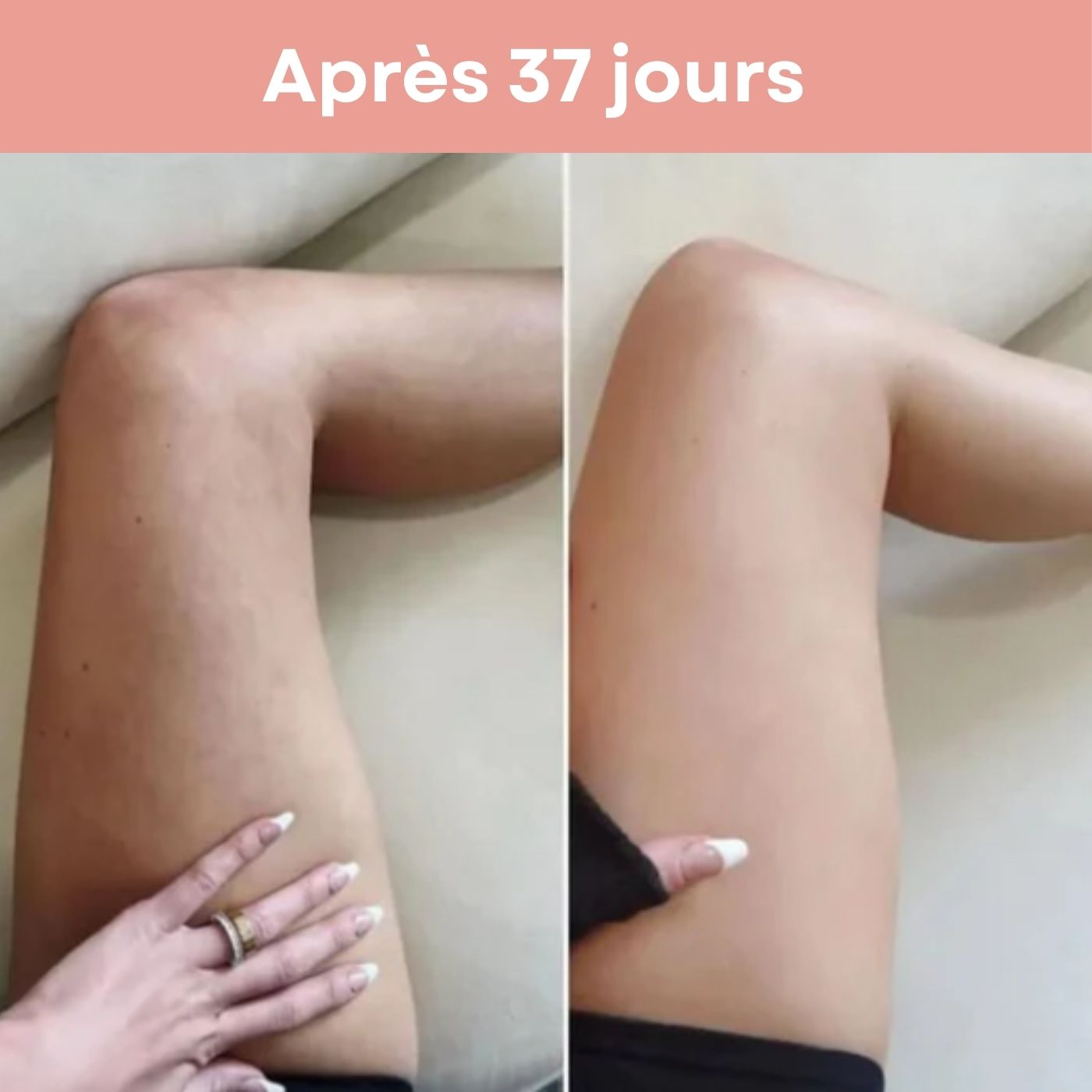 Appareil de Massage Anti-Cellulite BEAUTIFERA 3 en 1